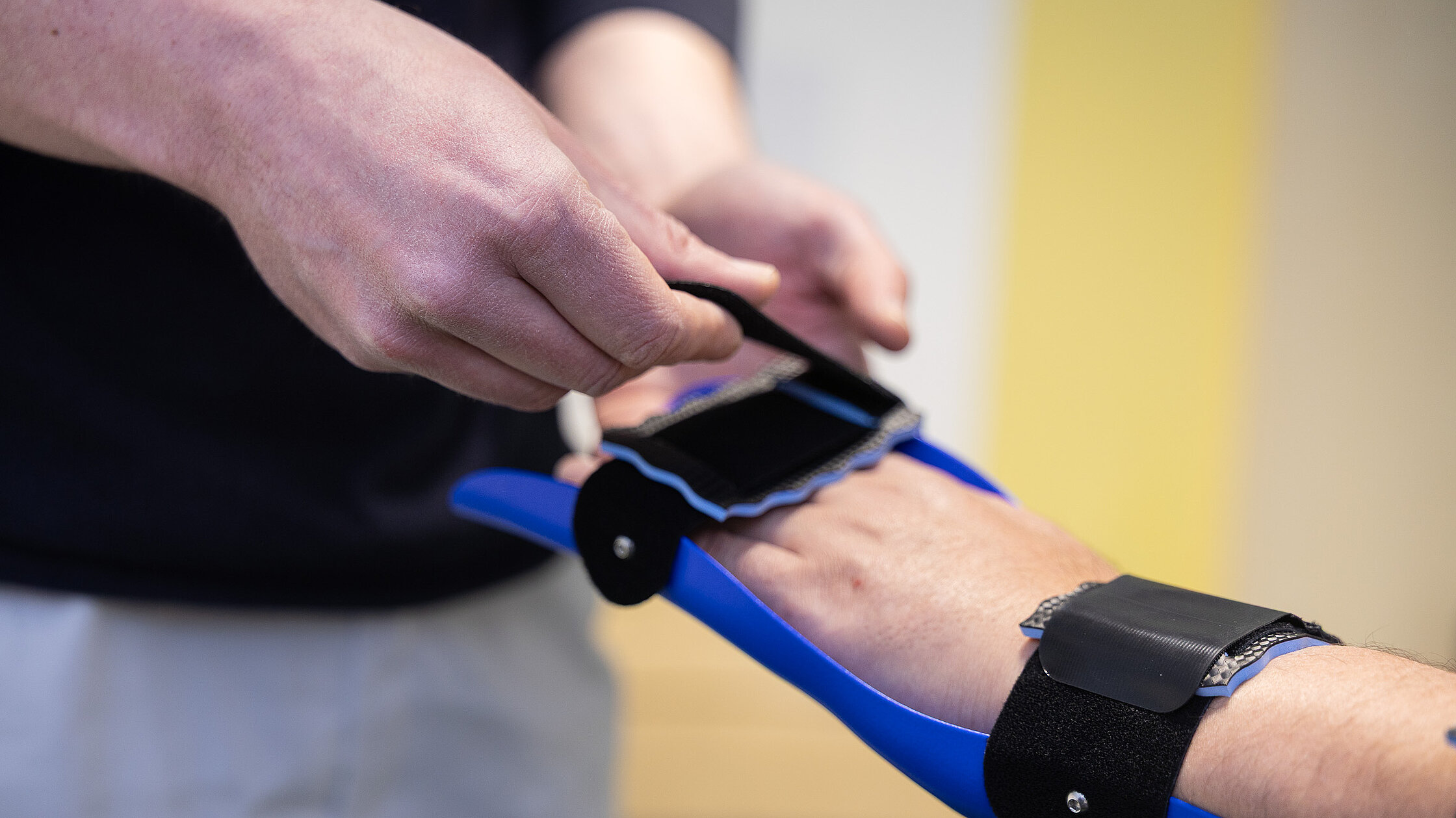 Nahaufnahme der Hände eines Orthopädietechnikers, der eine blaue Handorthese am Unterarm eines Patienten anpasst.